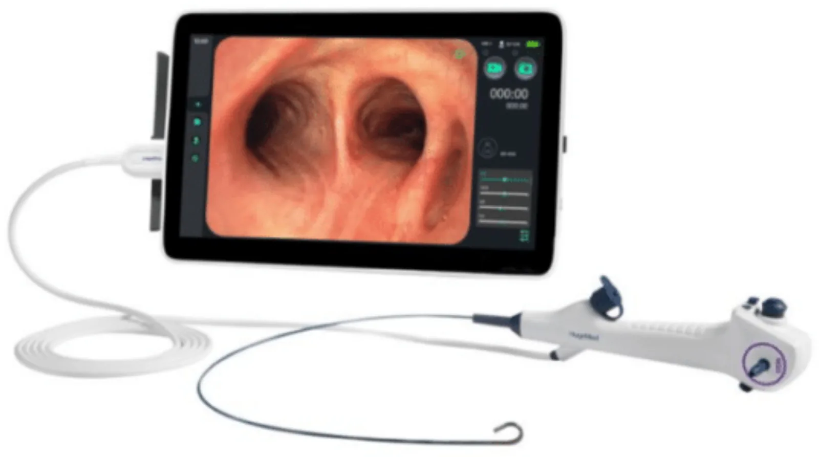 Procesador de imágenes médicas con pantalla táctil conectado a un videobroncoscopio.